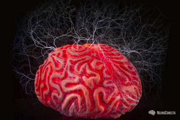 Epilepsia